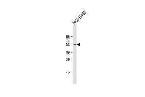 Anti-KRT36 Antibody (N-term) at 1:1000 dilution + NCI- whole cell lysate Lysates/proteins at 20 μg per lane. (Keratin 36 anticorps  (N-Term))