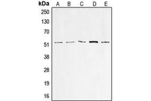 Western blot analysis of p53 expression in A549 (A), HeLa (B), HepG2 (C), MCF7 (D), A431 (E) whole cell lysates. (p53 anticorps  (N-Term))