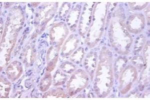 Immunohistochemistry of paraffin-embedded human kidney using TNFRSF10D / TRAIL-R4 / DCR2 antibody at dilution of 1:100. (DcR2 anticorps  (HRP))
