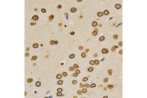 Immunohistochemistry (Paraffin-embedded Sections) (IHC (p)) image for anti-Lamin A/C (LMNA) (AA 403-572) antibody (ABIN3020785)