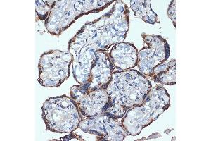 Immunohistochemistry of paraffin-embedded human placenta using P4HB Rabbit mAb (ABIN7269560) at dilution of 1:100 (40x lens). (P4HB anticorps)