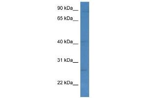 Western Blot showing KLRC1 antibody used at a concentration of 1 ug/ml against MCF7 Cell Lysate (KLRC1 anticorps  (C-Term))