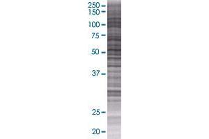 QRSL1 transfected lysate. (QRSL1 293T Cell Transient Overexpression Lysate(Denatured))