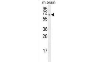 Western Blotting (WB) image for anti-F-Box Protein 21 (FBXO21) antibody (ABIN2996140) (FBXO21 anticorps)