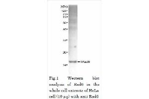 Western Blotting (WB) image for anti-Rad6 (full length) antibody (ABIN2452101)