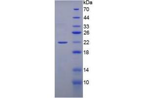 SDS-PAGE analysis of Rat Gremlin 1 Protein. (GREM1 Protéine)