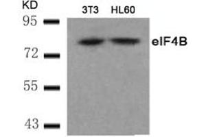 Image no. 2 for anti-Eukaryotic Translation Initiation Factor 4B (EIF4B) (AA 420-424) antibody (ABIN401569) (EIF4B anticorps  (AA 420-424))