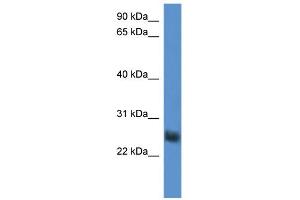 WB Suggested Anti-SLA2 Antibody Titration: 0. (SLAP2 anticorps  (Middle Region))