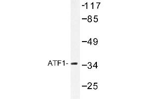 Image no. 1 for anti-Activating Transcription Factor 1 (AFT1) antibody (ABIN272179) (AFT1 anticorps)