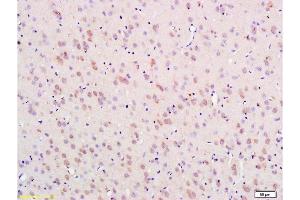 Formalin-fixed and paraffin embedded rat brain labeled with Anti-Nestin Polyclonal Antibody , Unconjugated 1:300 followed by conjugation to the secondary antibody and DAB staining (Nestin anticorps  (AA 681-750))