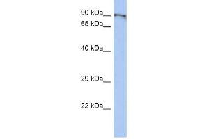 CXORF20 antibody used at 1 ug/ml to detect target protein. (BEND2 anticorps  (Middle Region))