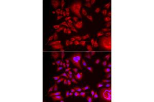 Immunofluorescence analysis of HeLa cell using BLMH antibody. (BLMH anticorps)