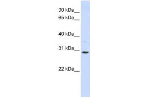 Western Blotting (WB) image for anti-Solute Carrier Family 25 (Carnitine/acylcarnitine Translocase), Member 20 (SLC25A20) antibody (ABIN2458773) (SLC25A20 anticorps)