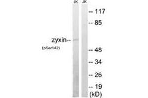 Western blot analysis of extracts from Jurkat cells treated with paclitaxel 1uM 24h, using Zyxin (Phospho-Ser142) Antibody. (ZYX anticorps  (pSer142))