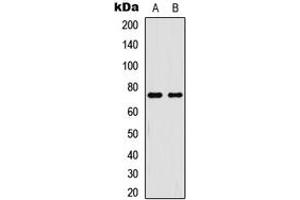 Western blot analysis of NF-kappaB p65 (pT254) expression in HeLa TNFa-treated (A), HL60 TNFa-treated (B) whole cell lysates. (NF-kB p65 anticorps  (pSer254))