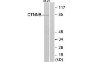 Western blot analysis of extracts from HT-29 cells, treated with Forskolin, using Catenin-beta (Ab-37) Antibody. (beta Catenin anticorps  (AA 3-52))