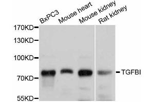 Western blot analysis of extracts of various cell lines, using TGFBI antibody (ABIN5999036) at 1/1000 dilution. (TGFBI anticorps)