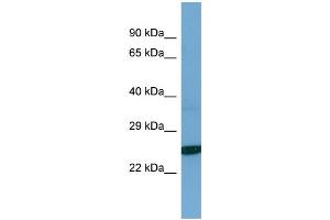 Host: Rabbit Target Name: TESC Sample Type: Jurkat Whole Cell lysates Antibody Dilution: 1. (Tescalcin anticorps  (C-Term))