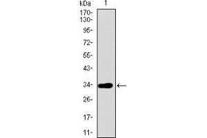 Western blot analysis using ABCG5 mAb against human ABCG5 recombinant protein. (ABCG5 anticorps  (AA 306-367))