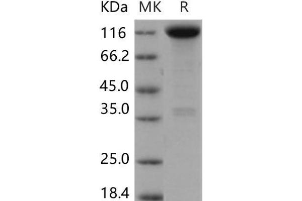 TRKA Protein (Fc Tag)