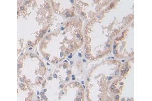 Used in DAB staining on fromalin fixed paraffin- embedded kidney tissue (BPGM anticorps  (AA 29-242))