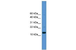 WB Suggested Anti-CASP1  Antibody Titration: 0. (Caspase 1 anticorps  (Middle Region))