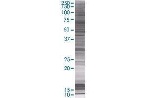 CDKL3 transfected lysate. (CDKL3 293T Cell Transient Overexpression Lysate(Denatured))