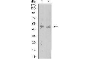 Western Blotting (WB) image for anti-ROP1 (AA 42-183) antibody (ABIN5869166) (ROP1 (AA 42-183) anticorps)