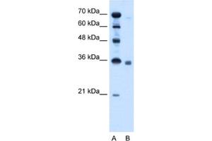 Western Blotting (WB) image for anti-Sphingosine-1-Phosphate Phosphatase 2 (SGPP2) antibody (ABIN2462892) (SGPP2 anticorps)