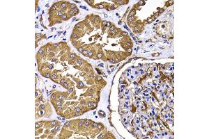 Immunohistochemistry of paraffin-embedded human kidney using TGS1 antibody (ABIN5975205) at dilution of 1/100 (40x lens). (TGS1 anticorps)