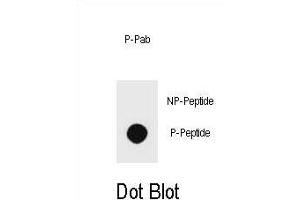 Dot blot analysis of Phospho-PTEN- Antibody Phospho-specific Pab (ABIN6241047 and ABIN6578933) on nitrocellulose membrane. (PTEN anticorps  (pSer229))