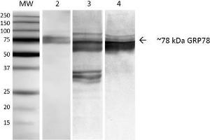 Western Blot analysis of Human, Mouse, Rat NIH3T3, Rat Brain, and HEK-293 cell lysates showing detection of ~78 kDa GRP78 protein using Mouse Anti-GRP78 Monoclonal Antibody, Clone 3C5-1A4 . (GRP78 anticorps  (APC))