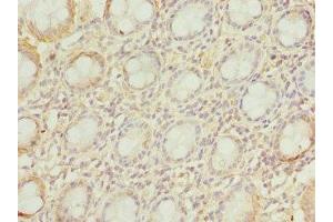 Immunohistochemistry of paraffin-embedded human colon tissue using ABIN7175527 at dilution of 1:100 (VSNL1 anticorps  (AA 1-191))