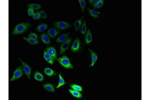 Immunofluorescent analysis of Hela cells using ABIN7156679 at dilution of 1:100 and Alexa Fluor 488-congugated AffiniPure Goat Anti-Rabbit IgG(H+L) (IFITM1 anticorps  (AA 1-36))