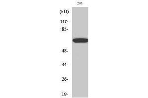 Western Blotting (WB) image for anti-Paxillin (PXN) (Thr507) antibody (ABIN3176785) (Paxillin anticorps  (Thr507))
