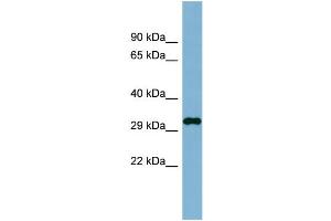 WB Suggested Anti-C20orf116 Antibody Titration:  0. (DDRGK1 anticorps  (N-Term))