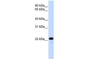 WB Suggested Anti-CDKN1B Antibody Titration:  0. (CDKN1B anticorps  (C-Term))