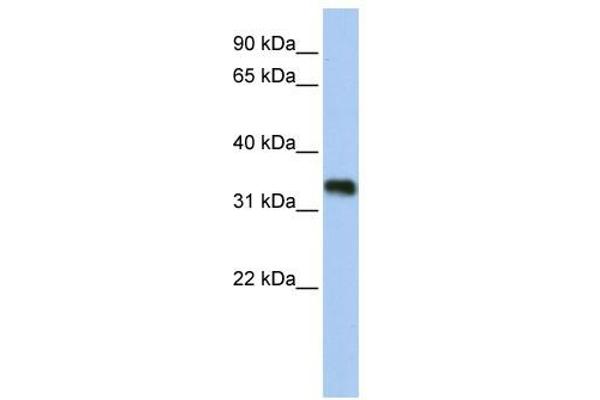 GLYATL3 anticorps  (N-Term)