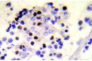 Immunohistochemistry (IHC) analyzes of p-Histone H2A. (H2AFX anticorps  (pSer139))