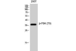 Western Blotting (WB) image for anti-PDZ Binding Kinase (PBK) (pThr9) antibody (ABIN3173023) (PBK anticorps  (pThr9))