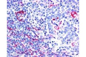 IHC testing of FFPE human tonsil with NET1 antibody at 2. (NET1 anticorps)