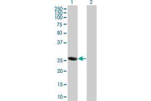 Lane 1: ORC6L transfected lysate ( 27. (ORC6L 293T Cell Transient Overexpression Lysate(Denatured))