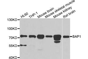 Western blot analysis of extracts of various cell lines, using BAP1 antibody (ABIN5973917) at 1/1000 dilution. (BAP1 anticorps)