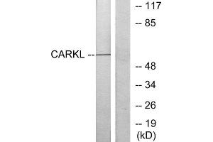 Western Blotting (WB) image for anti-Sedoheptulokinase (SHPK) (N-Term) antibody (ABIN1850060) (SHPK anticorps  (N-Term))