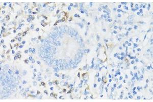 Immunohistochemistry of paraffin-embedded Human appendix using CD11A Polyclonal Antibody at dilution of 1:100 (40x lens). (ITGAL anticorps)