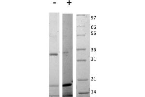 SDS-PAGE of Rat Interleukin-17E (IL-25) Recombinant Protein SDS-PAGE of Rat Interleukin-17E (IL-25) Recombinant Protein. (IL-25 Protéine)