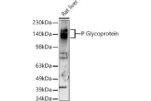 Western blot analysis of extracts of Rat liver, using P Glycoprotein antibody (ABIN7265732) at 1:500 dilution. (ABCB1 anticorps)