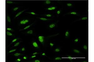 Immunofluorescence of monoclonal antibody to TCEA3 on HeLa cell. (TCEA3 anticorps  (AA 1-348))