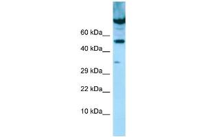 WB Suggested Anti-PDE7A Antibody Titration: 1. (PDE7A anticorps  (C-Term))
