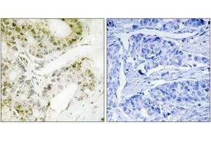 Immunohistochemistry (IHC) image for anti-Mediator Complex Subunit 13 (MED13) (AA 681-730) antibody (ABIN2889799) (MED13 anticorps  (AA 681-730))